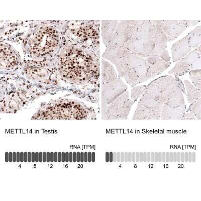 Immunohistochemistry-Paraffin: METTL14 Antibody (CL4252) [NBP2-59043]