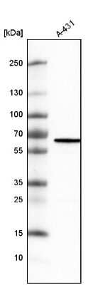 Western Blot: METTL14 Antibody (CL4252) [NBP2-59043]