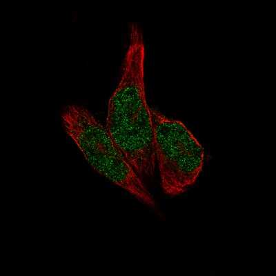 Immunocytochemistry/ Immunofluorescence: METTL14 Antibody (CL4254) [NBP2-59044]