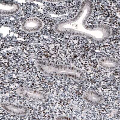 Immunohistochemistry-Paraffin: METTL14 Antibody (CL4254) [NBP2-59044]