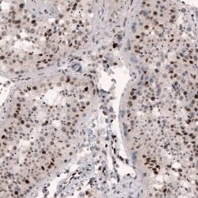 Immunohistochemistry-Paraffin: METTL14 Antibody (CL4254) [NBP2-59044]