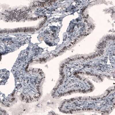 Immunohistochemistry-Paraffin: METTL14 Antibody (CL4254) [NBP2-59044]