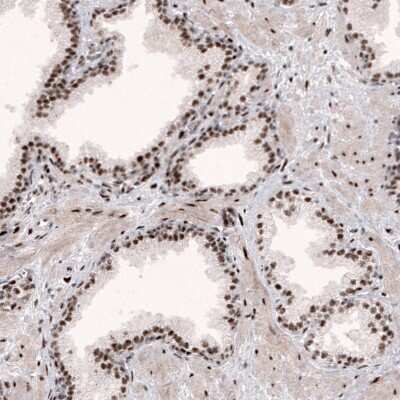Immunohistochemistry-Paraffin: METTL14 Antibody (CL4254) [NBP2-59044]