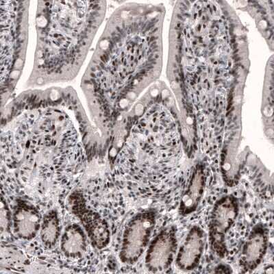 Immunohistochemistry-Paraffin: METTL14 Antibody (CL4254) [NBP2-59044]