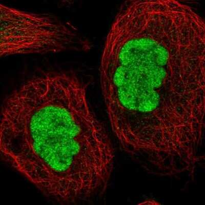 Immunocytochemistry/ Immunofluorescence: METTL14 Antibody [NBP1-81392]