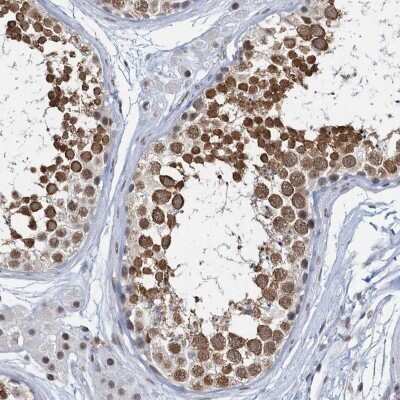 Immunohistochemistry-Paraffin: METTL14 Antibody [NBP1-81392]
