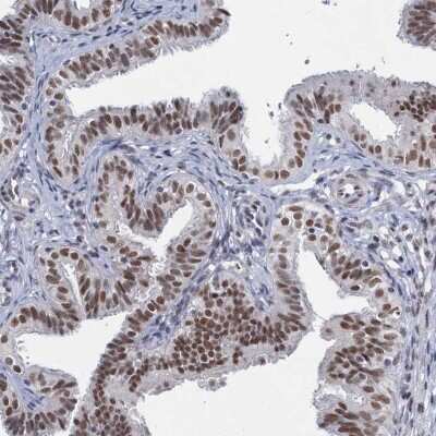 Immunohistochemistry-Paraffin: METTL14 Antibody [NBP1-81392]