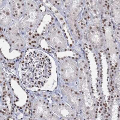 Immunohistochemistry-Paraffin: METTL14 Antibody [NBP1-81392]