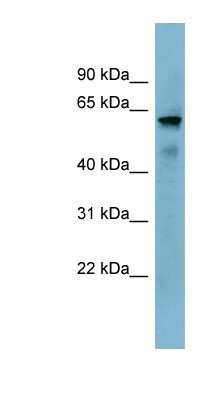 Western Blot: METTL14 Antibody [NBP1-79389]