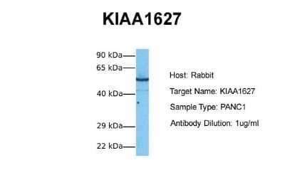 Western Blot: METTL14 Antibody [NBP1-79389]