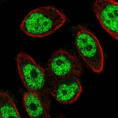 Immunocytochemistry/ Immunofluorescence: METTL19 Antibody [NBP1-92110]