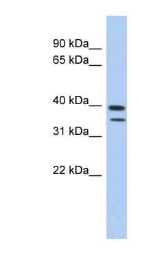 Western Blot: METTL19 Antibody [NBP1-70636]