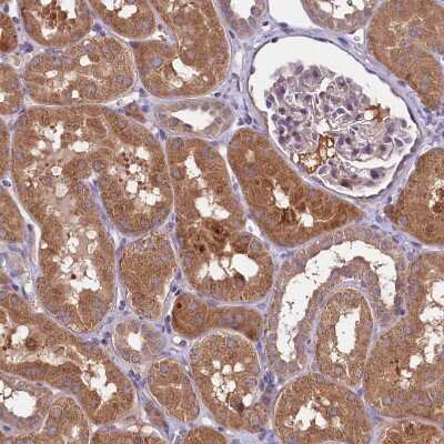 Immunohistochemistry-Paraffin: METTL20 Antibody [NBP1-87995]