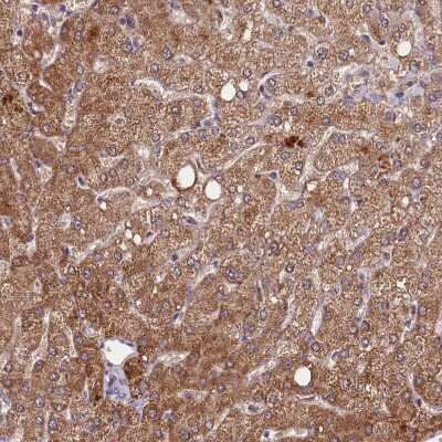 Immunohistochemistry-Paraffin: METTL20 Antibody [NBP1-87995]