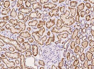Immunohistochemistry-Paraffin: METTL20 Antibody [NBP3-05952]