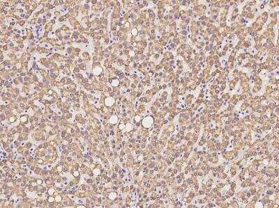 Immunohistochemistry-Paraffin: METTL20 Antibody [NBP3-05952]