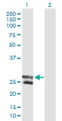 Western Blot: METTL20 Antibody [H00254013-B01P]