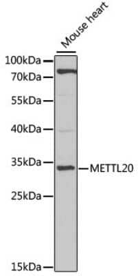 Western Blot: METTL20 AntibodyBSA Free [NBP3-04387]