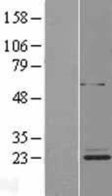 Western Blot: METTL20 Overexpression Lysate [NBL1-13082]