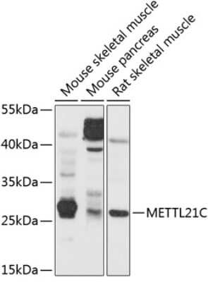 Western Blot: METTL21C AntibodyBSA Free [NBP3-04608]