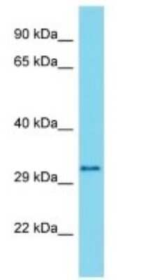 Western Blot: METTL21C Antibody [NBP3-09751]