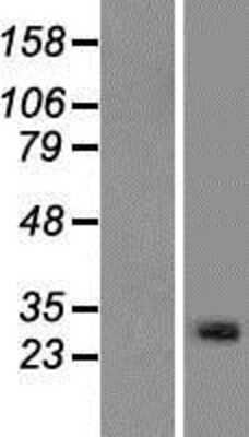 Western Blot: METTL21C Overexpression Lysate [NBP2-08774]