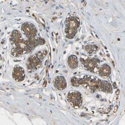 Immunohistochemistry-Paraffin: METTL21D Antibody [NBP1-93526]