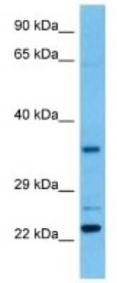 Western Blot: METTL21D Antibody [NBP3-10240]