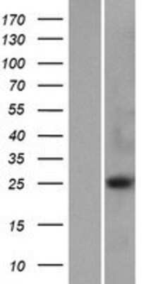 Western Blot: METTL21D Overexpression Lysate [NBP2-06312]