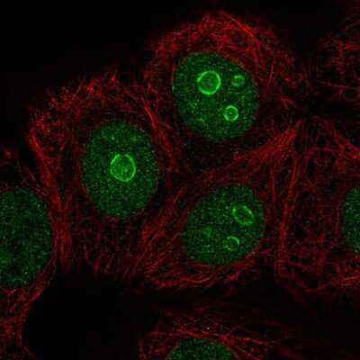 Immunocytochemistry/ Immunofluorescence: METTL22 Antibody [NBP2-56462]