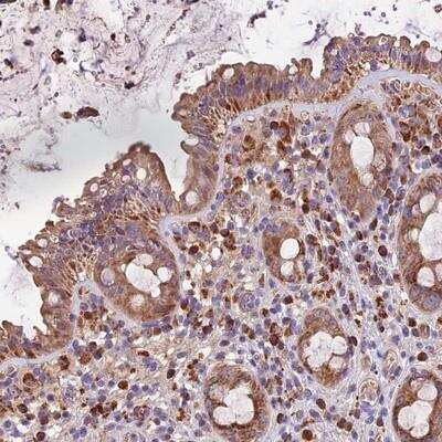 Immunohistochemistry: METTL22 Antibody [NBP1-94033]