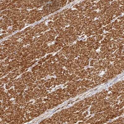 Immunohistochemistry: METTL22 Antibody [NBP2-38878]