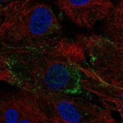 Immunocytochemistry/ Immunofluorescence: METTL23 Antibody [NBP3-17168]