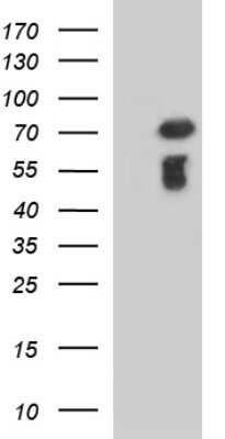 Western Blot: METTL25 Antibody (OTI2B6) [NBP2-46590]