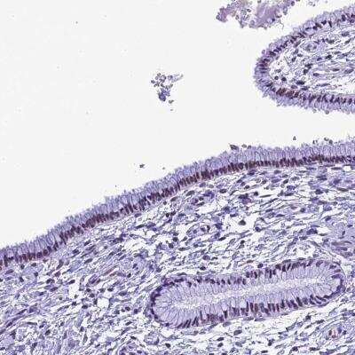 Immunohistochemistry: METTL25 Antibody [NBP1-82106]