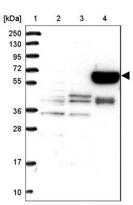 Western Blot: METTL25 Antibody [NBP1-82105]