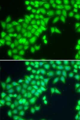 Immunocytochemistry/ Immunofluorescence: METTL2A Antibody - BSA Free [NBP3-04709]