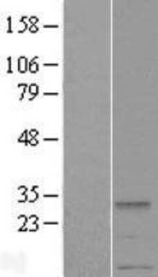 Western Blot: METTL2A Overexpression Lysate [NBL1-13023]