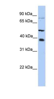 Western Blot: METTL2B Antibody [NBP1-55020]