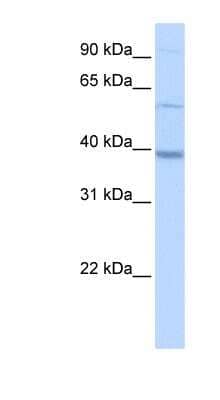 Western Blot: METTL2B Antibody [NBP1-55229]