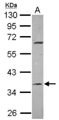 Western Blot: METTL2B Antibody [NBP2-17282]