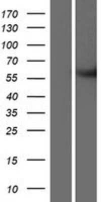 Western Blot: METTL2B Overexpression Lysate [NBP2-06799]