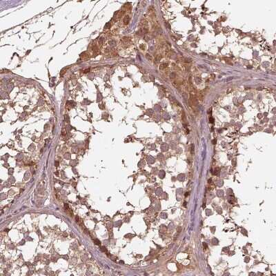 Immunohistochemistry: METTL4 Antibody [NBP2-68673]