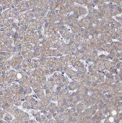 Immunohistochemistry-Paraffin: METTL4 Antibody [NBP1-82095]