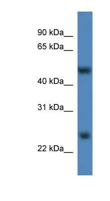 Western Blot: METTL4 Antibody [NBP1-79301]