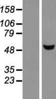 Western Blot: METTL4 Overexpression Lysate [NBL1-13024]