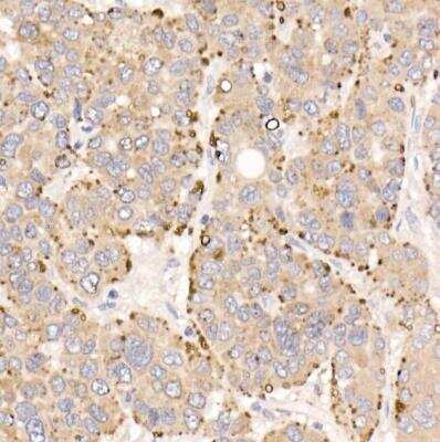 Immunohistochemistry-Paraffin: METTL7A Antibody - BSA Free [NBP3-04948]