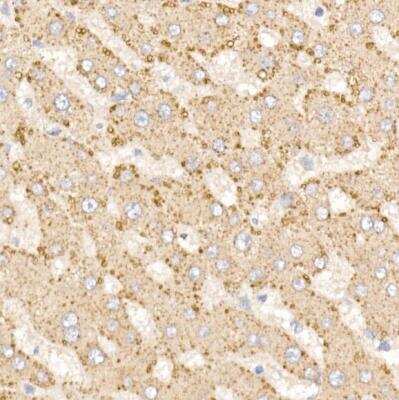 Immunohistochemistry-Paraffin: METTL7A Antibody - BSA Free [NBP3-04948]