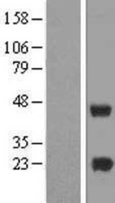 Western Blot: METTL7A Overexpression Lysate [NBP2-07376]