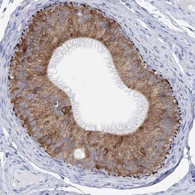Immunohistochemistry-Paraffin: METTL7B Antibody [NBP2-47377]